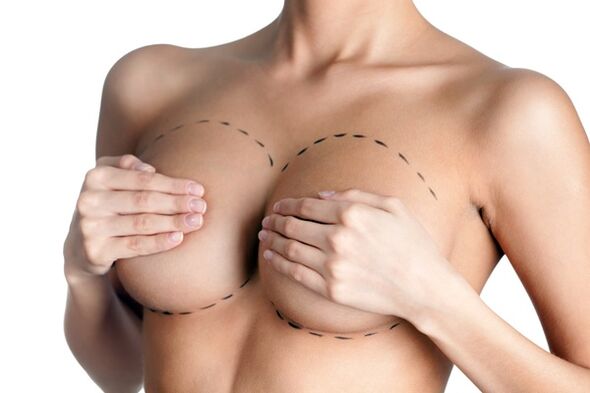 Augmentation mammaire plastique