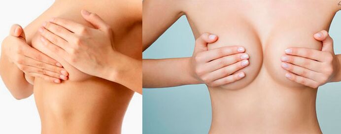 Auto-massage pour l'augmentation mammaire