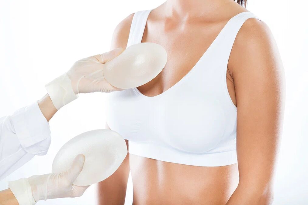 Choisir des implants avant une chirurgie d'augmentation mammaire