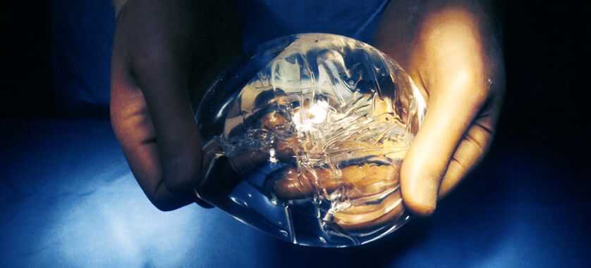 Endoprothèse en silicone