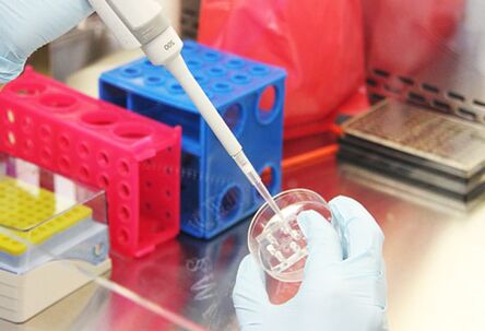 Examen des tests des patientes avant de réaliser une mammoplastie d'augmentation