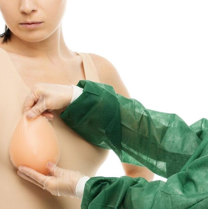 Implants d'élargissement mammaire